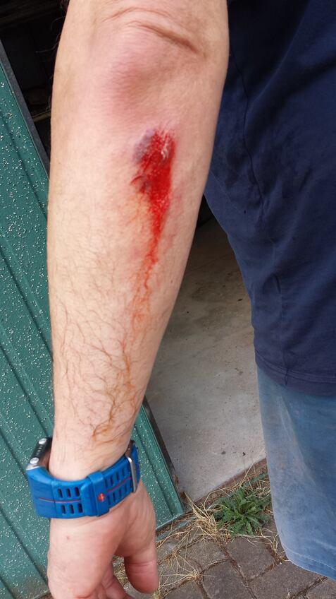 Blutende Wunde am Unterarm eines Mannes, sichtbar neben einem grünen Garagentor.